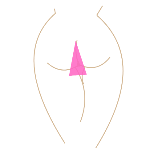 Depilación intergluteos